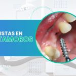 Dentistas en Matamoros: Direcciones, teléfonos, Servicios y precios