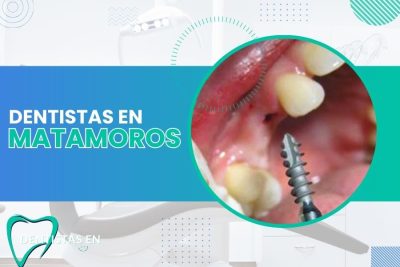 Dentistas en Matamoros